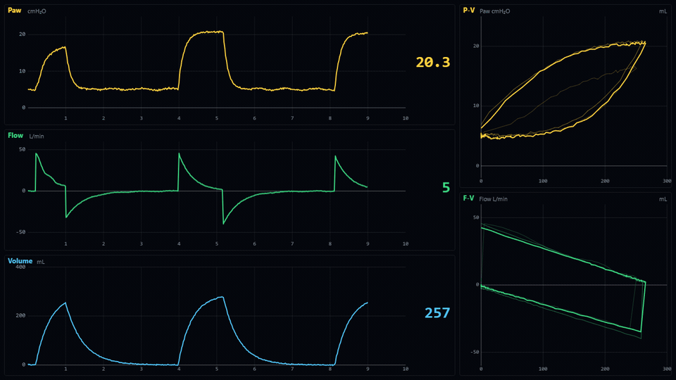 DRIVE live ventilator waveforms: Paw, Flow and Volume sweep traces with P-V and F-V loops